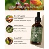 image:imageYANIBEST Batana Oil  Improve Scalp HealthBatana Oil