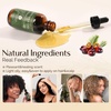 image:imageYANIBEST Batana Oil  Improve Scalp HealthBatana Oil